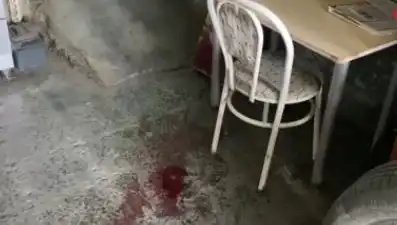 Sandalyeden Düşen Adamın Yaşadığı Talihsiz Kaza Hastaneye Kaldırdı
