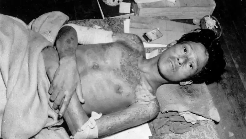 80 Yıl Sonra Nagasaki’den Uyarı: Nükleer Felaket Kapıda!