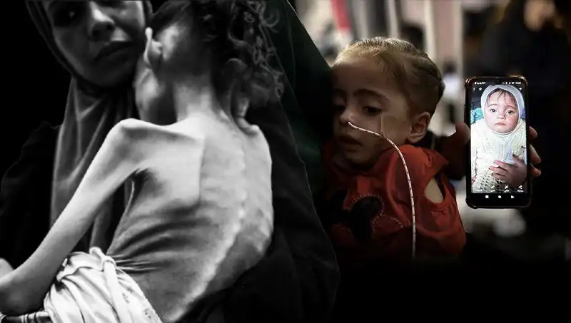 25 Kilodan 10 Kiloya Düşen 7 Yaşındaki Meryem'in Zorlu Mücadelesi