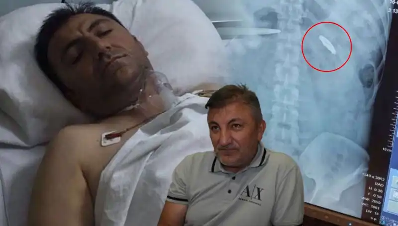 15 Temmuz’un Karanlık Yüzü: Vücudunda Kurşunla Taşıyan Bir Kahramanın Hikayesi